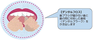 デンタルフロスの図