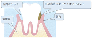 歯周組織図の図