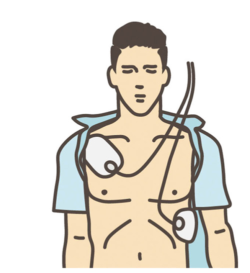 イラスト：AEDの使用