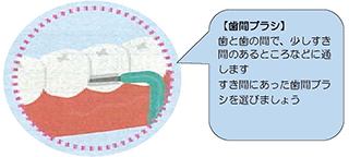 歯間ブラシの図