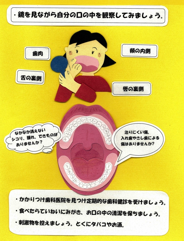 口腔がんのセルフチエックの画像